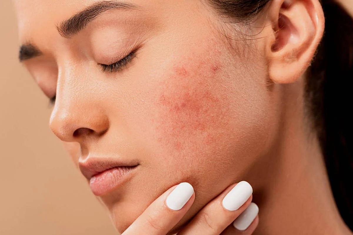 How To Help: Sensitive Skin