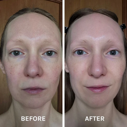 EGF + Collagen Renewal Booster